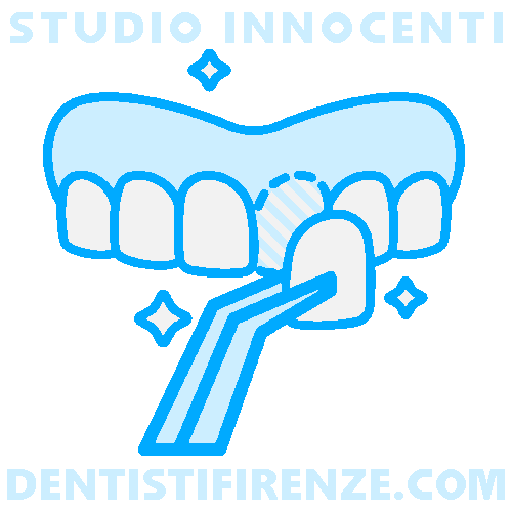 Faccette Dentali